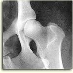 mobilization of the hip joint