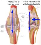 Medial Patellar Luxation