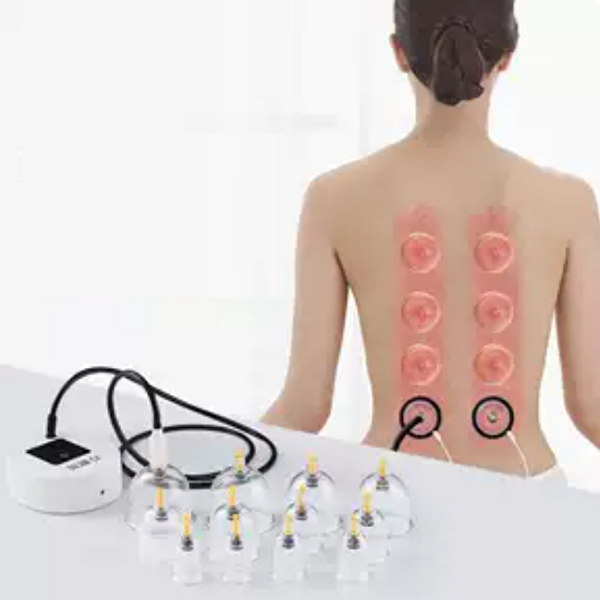 Terapia con Ventosas al Vacío