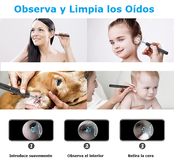 Limpiador de Oídos Visual Inteligente BEBIRD R3