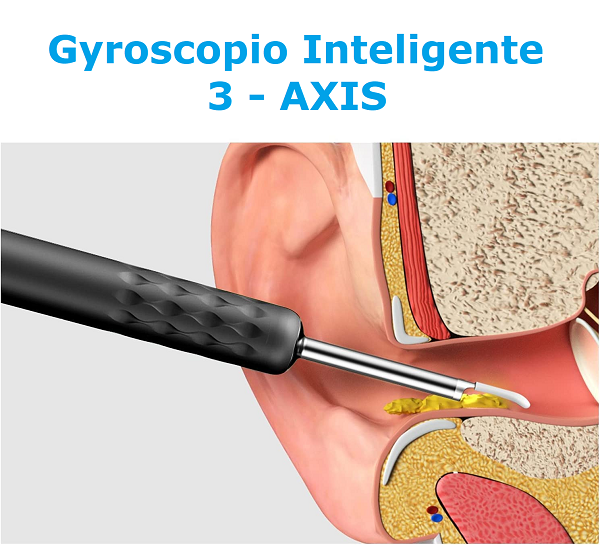 Limpiador de Oídos Visual Inteligente BEBIRD R3