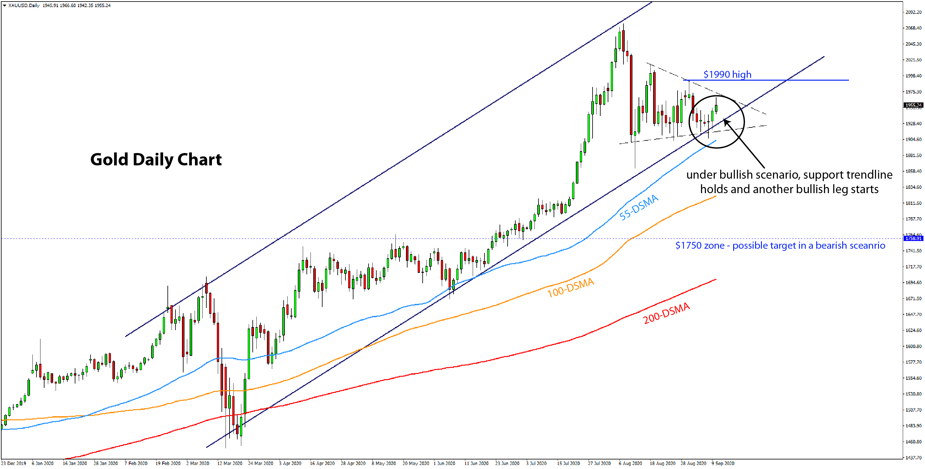 Gold Daily Chart scenarios