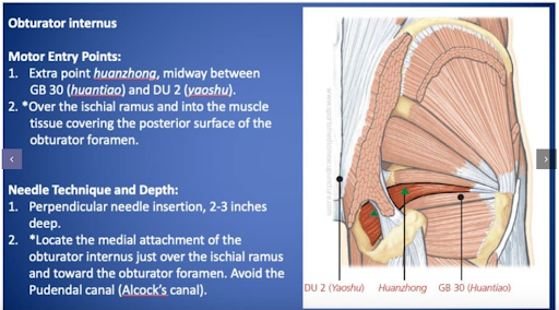 Obturator internus graphic