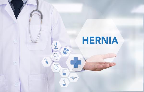 Hernia FAQ