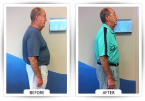 ChiroThin patient before and after weight-loss result