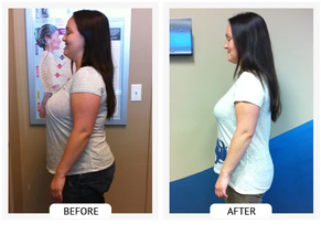 ChiroThin patient before and after weight-loss result