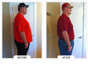 ChiroThin patient before and after weight-loss result