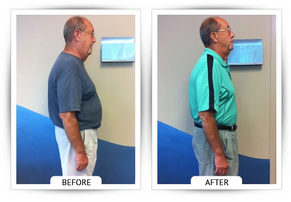 ChiroThin patient before and after weight-loss result