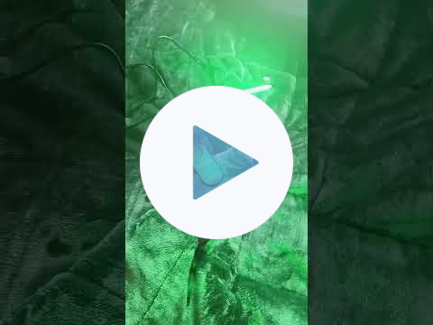 🟢GREEN LIGHT THERAPY💚MIGRAINES😣SLEEP🛌🏼STRESS😨SKIN👄PETS🐾PEOPLE💚#light #green #lighttherapy #migraine