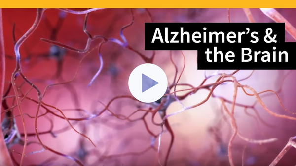 How Alzheimer's Changes the Brain