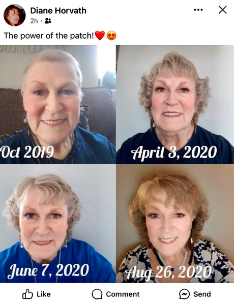 Benefits of X39 Stem Cell Patch for wellness and youthfulness