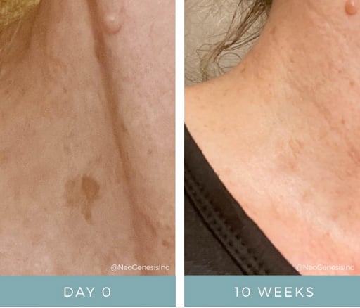 aging-clear skin trifecta