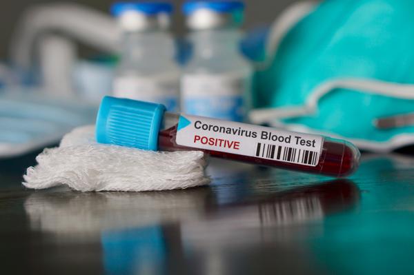 Coronavirus is Ravishing the Earth