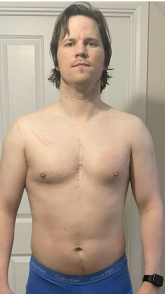 Brad before