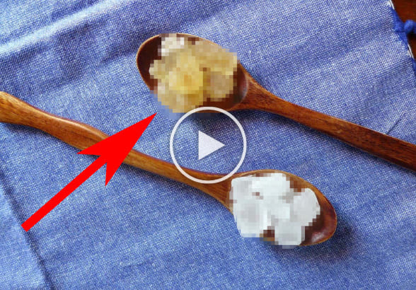 bladder sugar