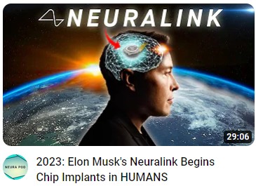 Neuralink