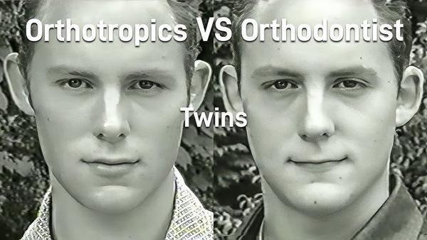 orthotropics vs orthodontics
