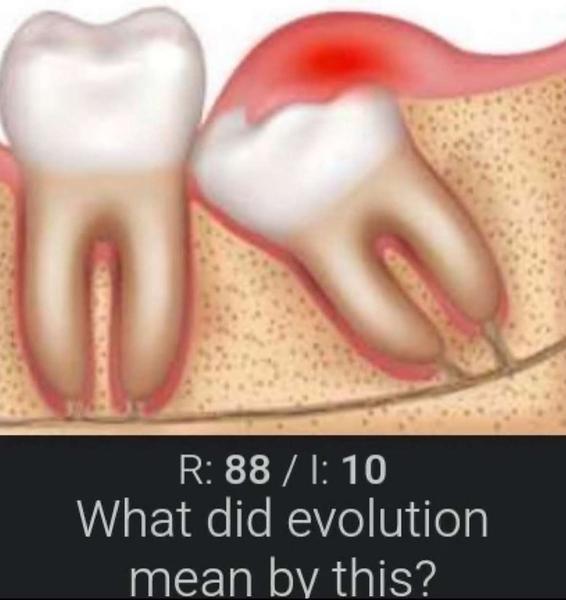 impacted wisdom tooth