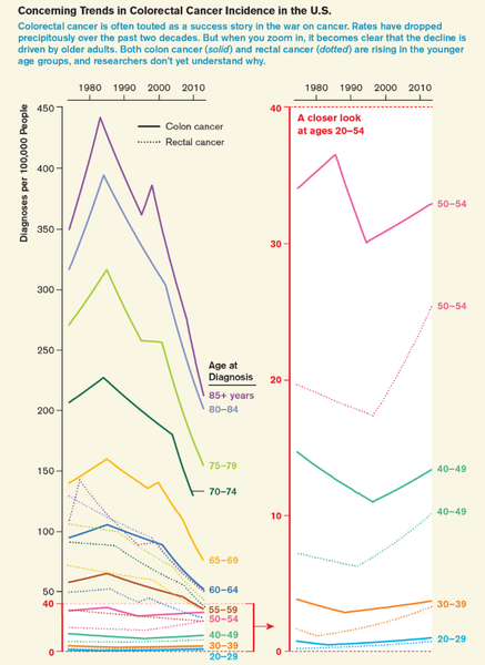 colon cancer trends