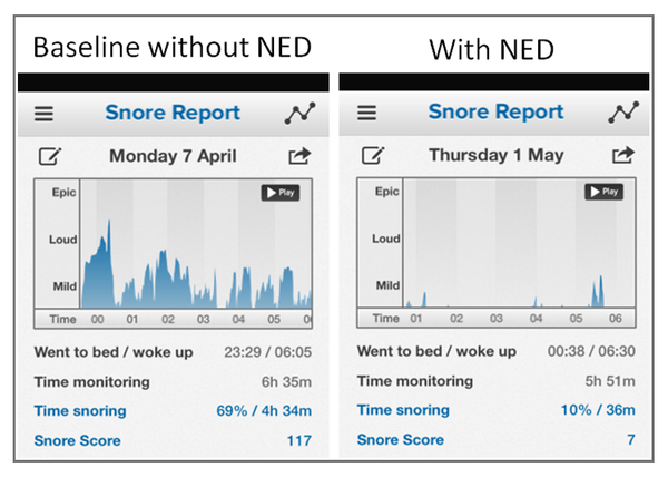 Snore Report