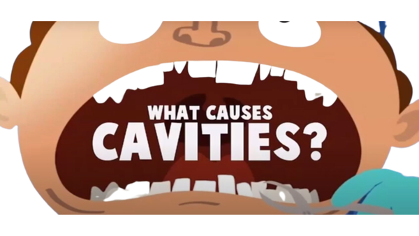 what causes cavities