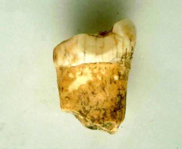 Neanderthal Tooth