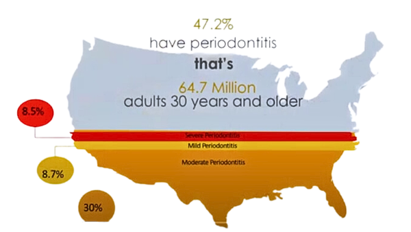 Periodontal Prevalence