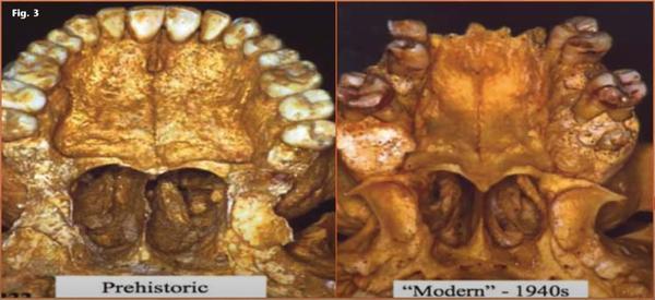 modern and ancient teeth