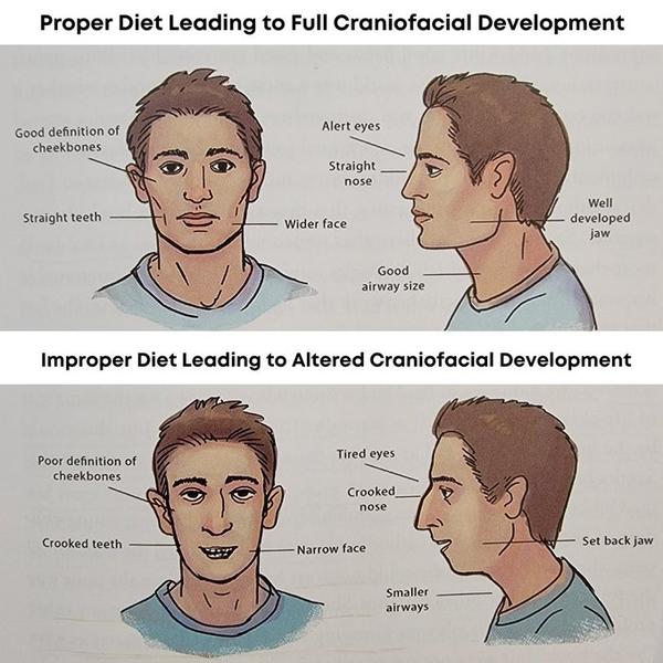 nutrition and facial development