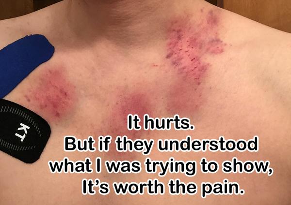 Taking Pains for Others to Improve