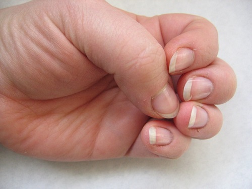 fingernails