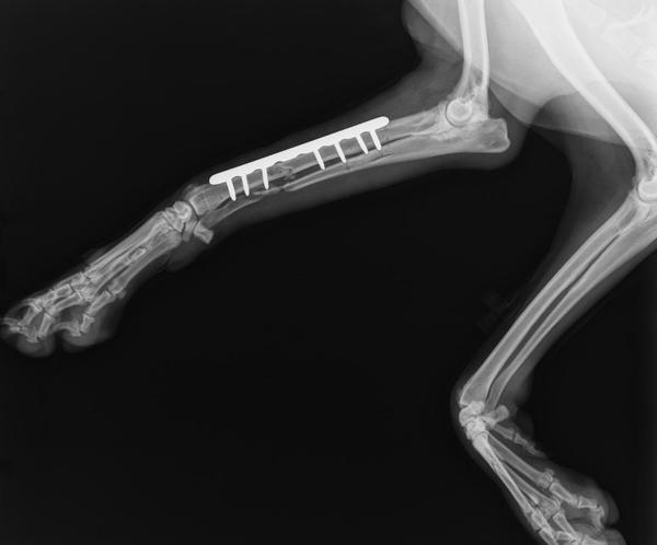 Repair of fractured radius & ulna