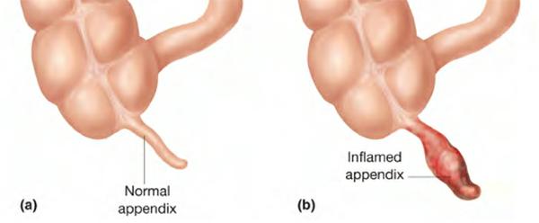 Appendix