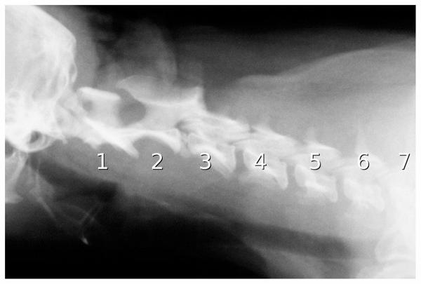 Cervical Spine