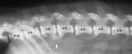Spondylosis