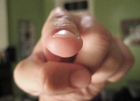 Diaphragm Release