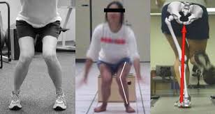 Glutes&TheKnee
