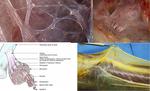 Myofascia