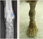 Fracture Management