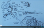 Facial Nerve Paralysis