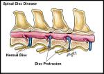 Dog Spine