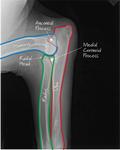 CanineElbow