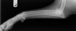 Elbow Osteoarthritis