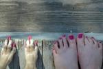 Dog toes!