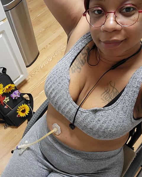A black woman sitting on a chair with a tube coming out of her belly. She has some tattoos on her chest, a nose piercing and red, circular glasses. She
wears grey pants and a grey top. 