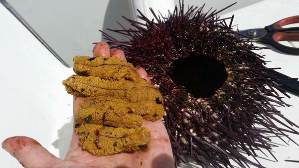 Uni