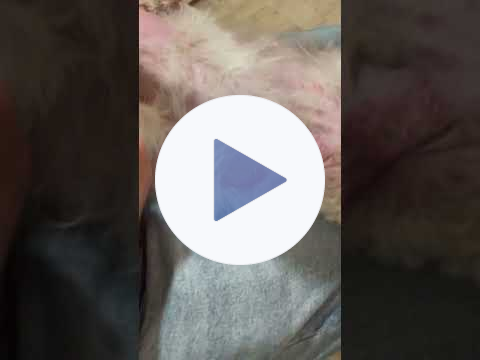 Prince VSEL treatment