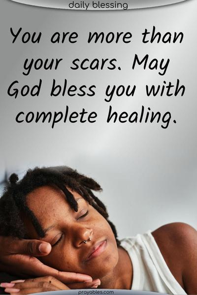 You are more than your scars. May God bless you with complete healing.