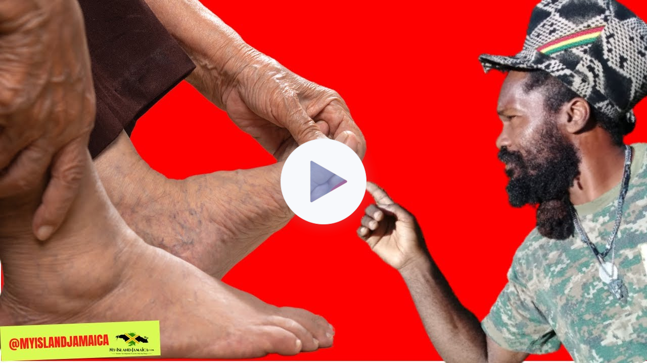Say GOODBYE to Poor Circulation! 7 POWERFUL Herbs for Improved Blood Flow!" 🇯🇲 #homeremedies #rasta