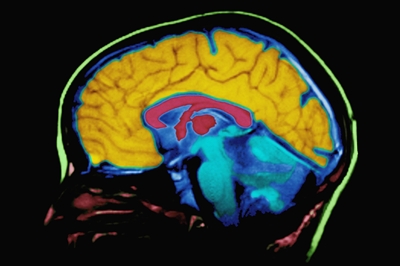 prefrontal cortex is slower to respond